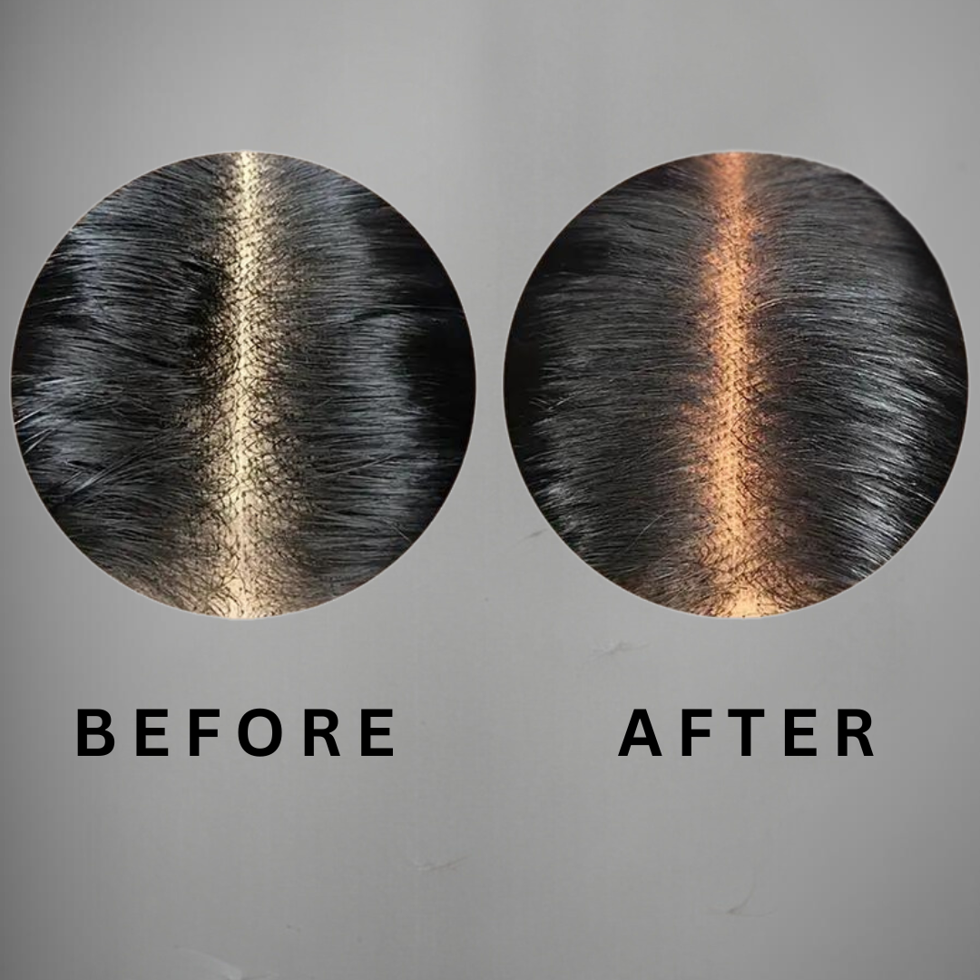 Ultimate Wig Install Kit